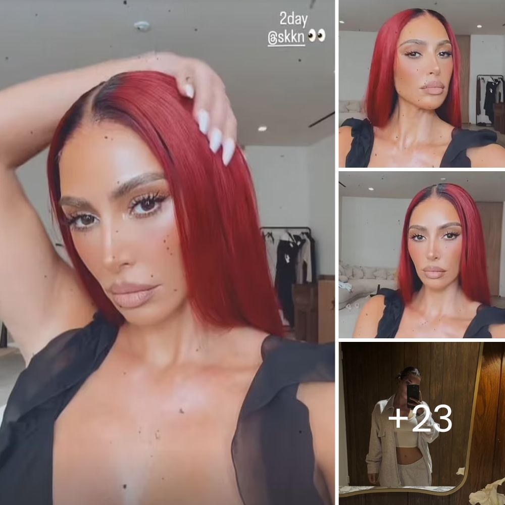 A ‘Fighting Bait’ Dog Who Lost Half Her Face Becomes Unrecognizable After Finding a Loving Home