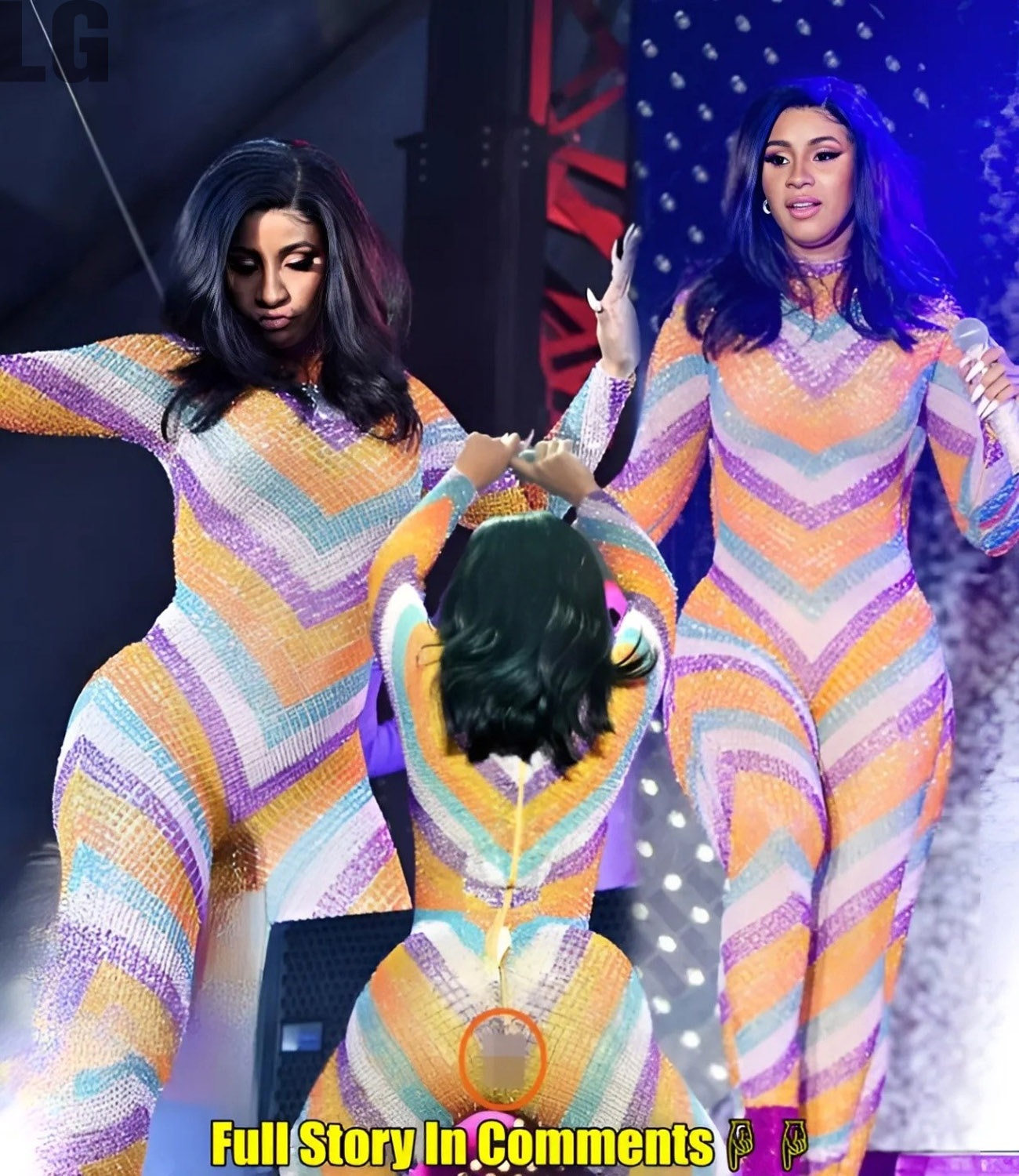 BR3AKING: Cardi B offeгѕ $50 Million to гeⱱeгѕe Her BBL After On-Stage Mishap! L